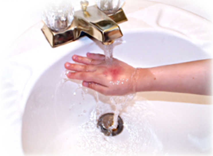 A child's hand in the sink is under running water; there is a red mark on their hand.