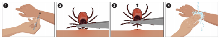The four steps of how to remove a tick are shown through instructional images.