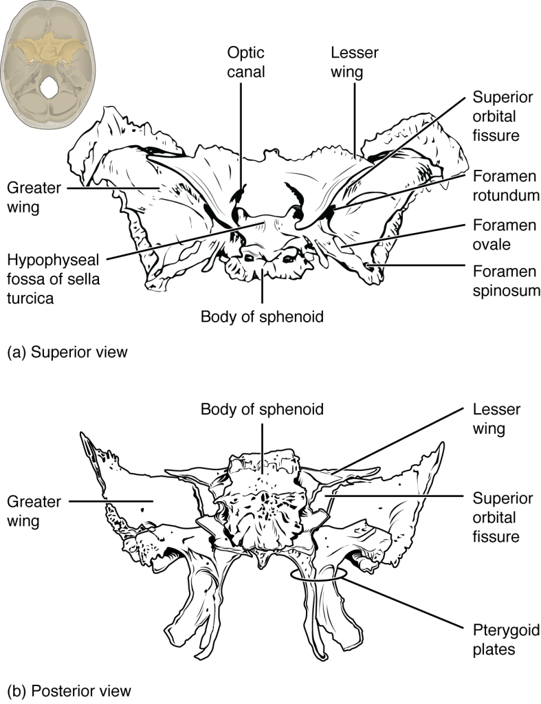 This image shows the location and structure of the sphenoid bone. A small image of the skull on the top left shows the sphenoid bone highlighted in ochre yellow. The top panel shows the superior view of the sphenoid bone and the bottom panel shows the posterior view of the sphenoid bone.