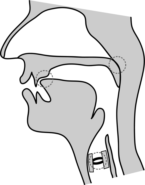 Diagramme médiosagittal montrant l’avant de la langue près de la crête alvéolaire, le voile du palais soulevé et les cordes vocales non vibrantes.