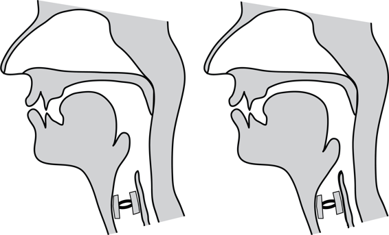 Deux diagrammes médiosagittaux, celui de gauche illustrant une racine de langue avancée, et celui de droite une racine de langue rétractée.