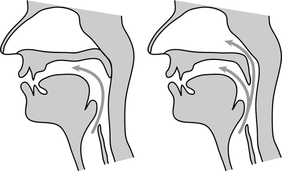 Deux diagrammes médiosagittaux illustrant le flux d’air oral uniquement attribuable à un voile de palais surélevé (à gauche) et le flux d’air oral et nasal simultané attribuable à un voile de palais abaissé (à droite).
