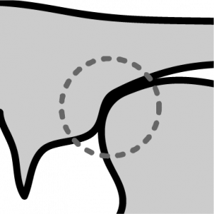 Diagramme médiosagittal de la lame de la langue en contact avec l’arrière de la crête alvéolaire.