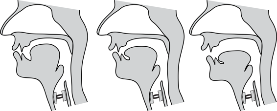 Trois diagrammes médiosagittaux illustrant des positions haute, intermédiaire et basse de la langue.