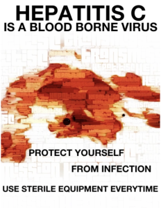 Harm reduction poster for Hepatitis C. The text says, "Hepatitis C is a blood borne virus. Protect yourself from infection. Use sterile equipment every time." The image is evocative of a blood splatter.