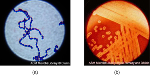 Photos of Gram Stain Specimins