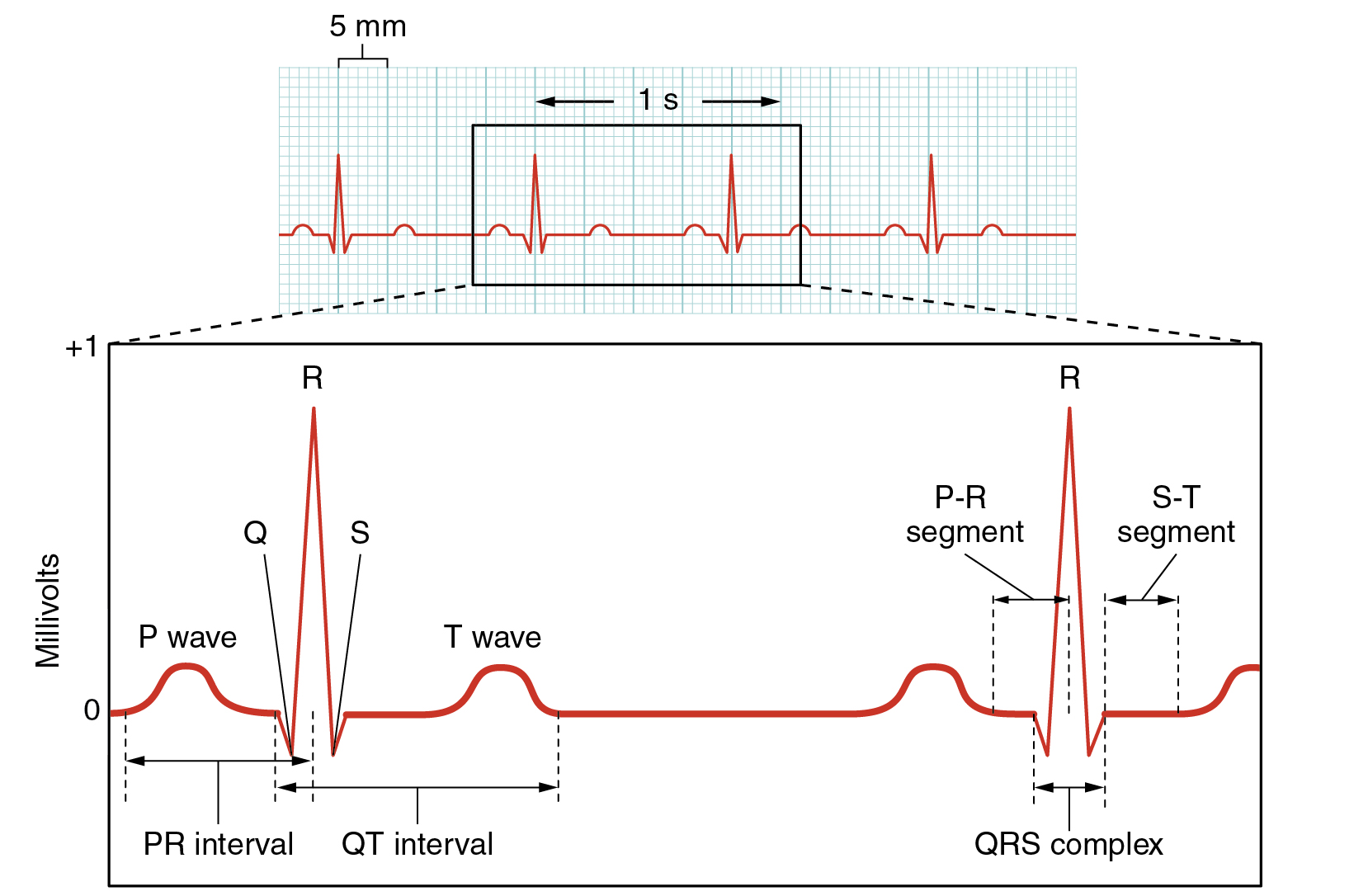 Illustration, with labels, showing an electrocardiogram tracing.