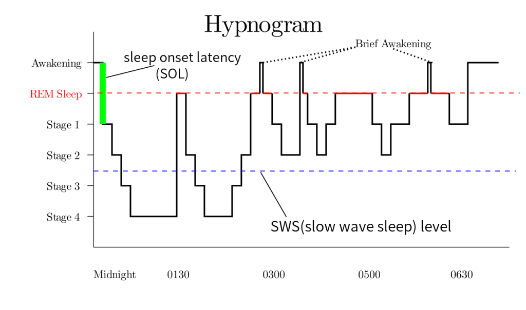 Image of a hypnogram showing stages of sleep