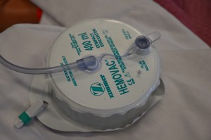 Hemovac drain