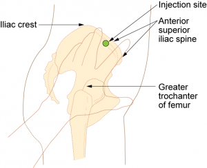 Ventrogluteal intramuscular injection site