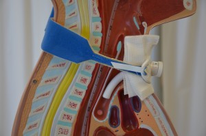 Cross-section view of a tracheostomy (on a model) inserted in the trachea anterior to the esophagus