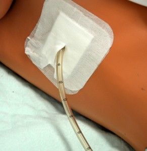 Chest tube Insertion site