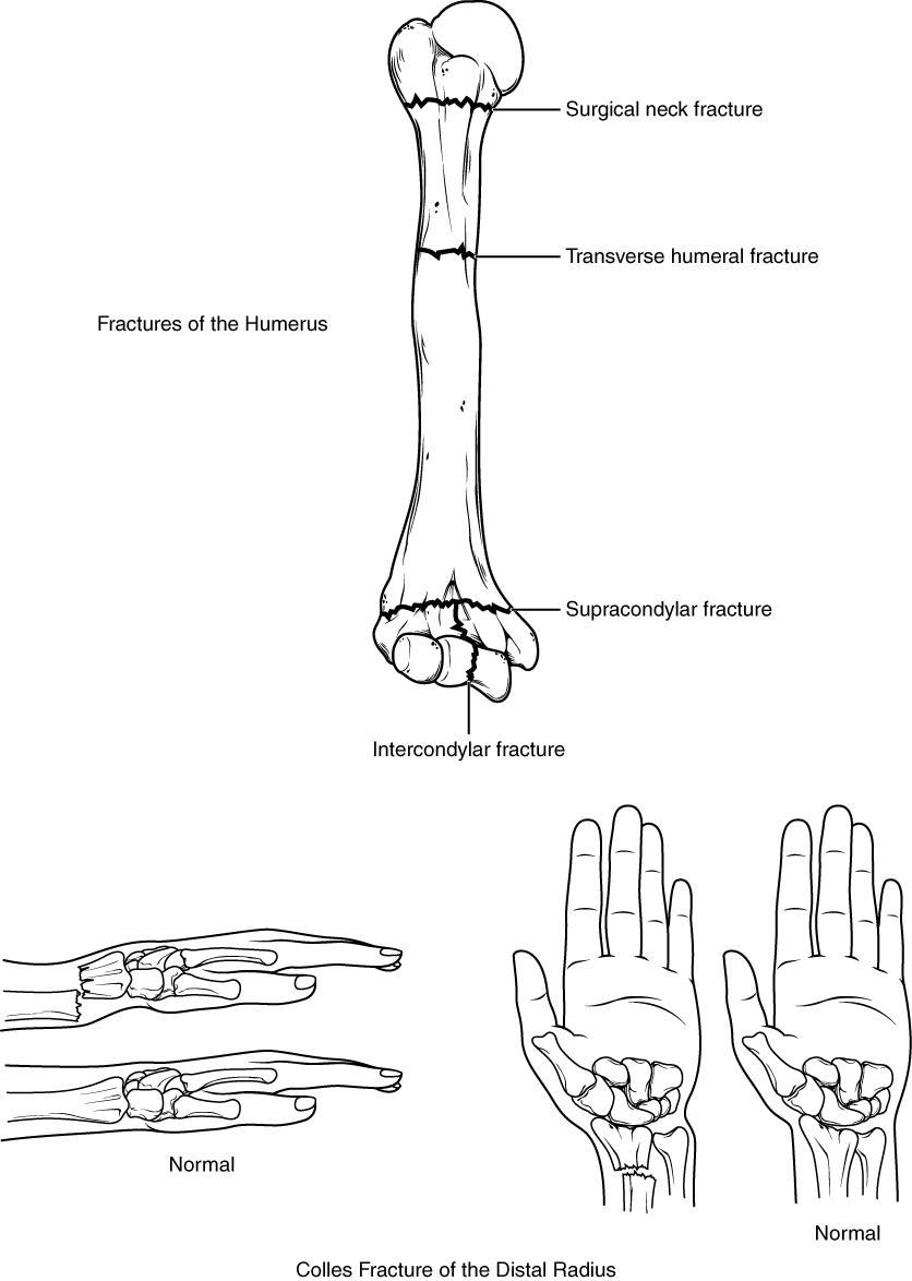 6.7: Bones of the Upper Limb - Medicine LibreTexts