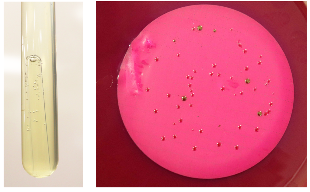 Left image shows test tube with gas bubbles. Right image shows petri plate with green or gold bacterial cultures.