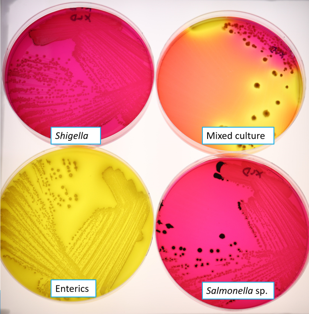 Bacteria on XLD aga: Shigella, Mixed culture, Enterics, Samonella sp.