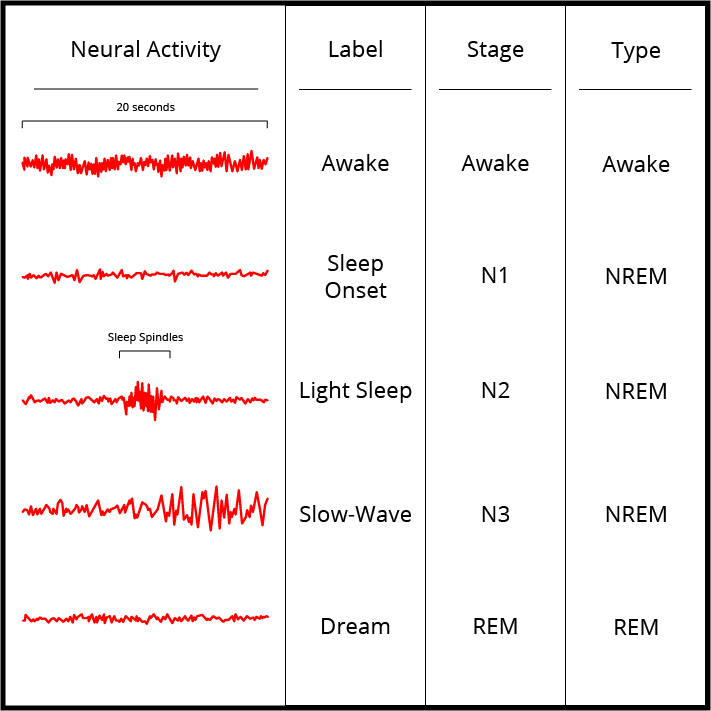 a chart of neural activity