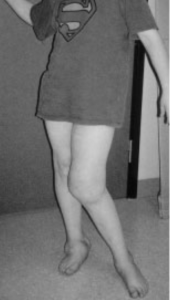 black and white photo of a persons bare legs