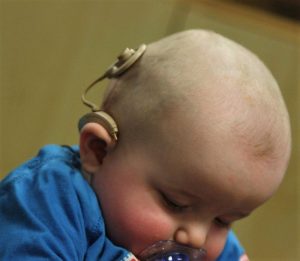 Photo of infant with hearing aids