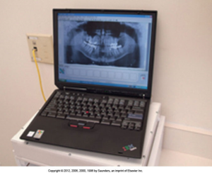 A laptop displaying a panoramic dental X-ray image on its screen.