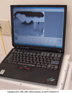 A laptop screen showing a periapical dental X-ray image, possibly for diagnostic or review purposes in a dental office.