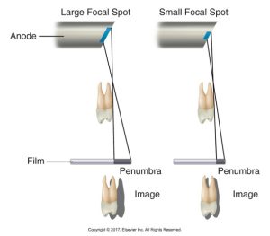 Comparison of dental X-ray images showing the effect of large and small focal spots on image sharpness and the extent of the penumbra, or blurred edges, around the tooth representation.