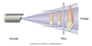 Illustration showing the cone of radiation from an X-ray anode to film, with two teeth depicted at different distances from the film, resulting in different image sizes.