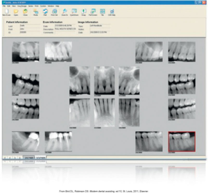 image displaying a full-mouth series of digital images displayed on a computer monitor.