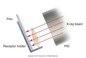 Illustration of an X-ray setup with a film in a receptor holder and a tooth, showing the X-ray beam from a PID producing a non-distorted image on the film.