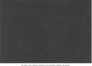 An image of a completely black film sheet, indicating exposure to light, typically seen in radiographic film that has been unintentionally exposed.