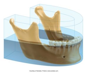 A 3D rendering of a human jaw with teeth, overlaid with transparent layers illustrating the focal trough areas used in panoramic dental imaging. This visual demonstrates the specific regions of interest captured during the scan.