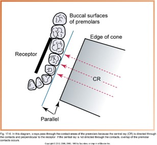 In this diagram, x-rays pass through the contact areas of the premolars because the central ray (CR) is directed through the contacts and perpendicular to the receptor. If the central ray is not directed through the contacts, overlap of the premolar contacts occurs.