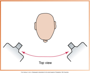 The image is a top view diagram showing a head and two dental X-ray units positioned to demonstrate horizontal angulation.