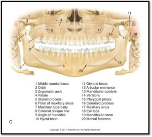 An illustrated diagram of a human skull viewed from the front, showing both the upper and lower jaws. The image includes numbered labels identifying various anatomical features such as the zygomatic arch, mandibular canal, and maxillary sinus.