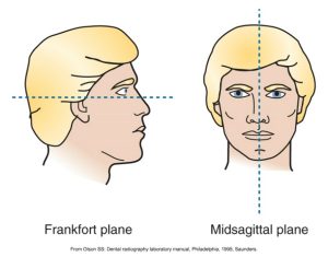 Illustration showing the anatomical planes used in dental imaging: the Frankfort plane, indicated by a horizontal line through the profile view, and the midsagittal plane, marked by a vertical line through the front view of a face. These reference lines are critical for proper patient positioning in radiographic procedures.