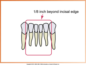 The image illustrates the correct placement of a dental X-ray receptor, positioned 1/8 inch beyond the incisal edge of the teeth, highlighted with a pink outline around the teeth.