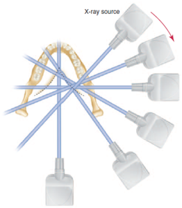 A graphic illustration showing multiple X-ray sources pointing towards a central dental structure from different angles, representing the rotational center of the X-ray beams during a dental imaging procedure. The diagram highlights the concept of a focal point where all X-ray beams converge.