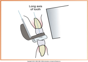 Illustration showing the long axis of a tooth in relation to dental x-ray equipment.