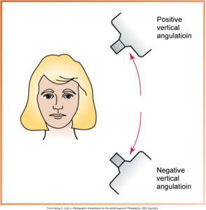 The image depicts a diagram illustrating positive and negative vertical angulations in dental X-ray imaging, featuring a head portrait and two X-ray units.