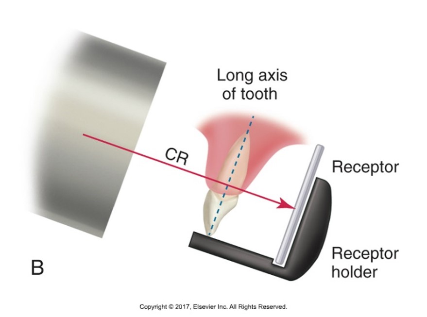 The image shows a dental X-ray setup diagram labeled "B", with the long axis of a tooth, a receptor in its holder, and a line labeled "CR" indicating the central ray of the X-ray beam.