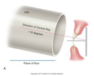 Illustration showing a dental X-ray setup with the Position Indicating Device (PID) directed at a +10 degree angle toward the teeth.