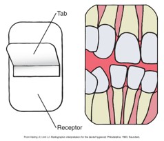 showing a dental X-ray tab and receptor placement for capturing an image of multiple teeth.