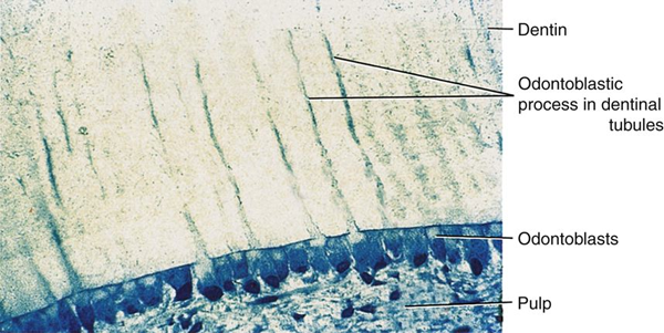 A micrograph of dentin showing the dentinal tubules with odontoblastic processes, the layer of odontoblasts, and the adjacent pulp tissue.