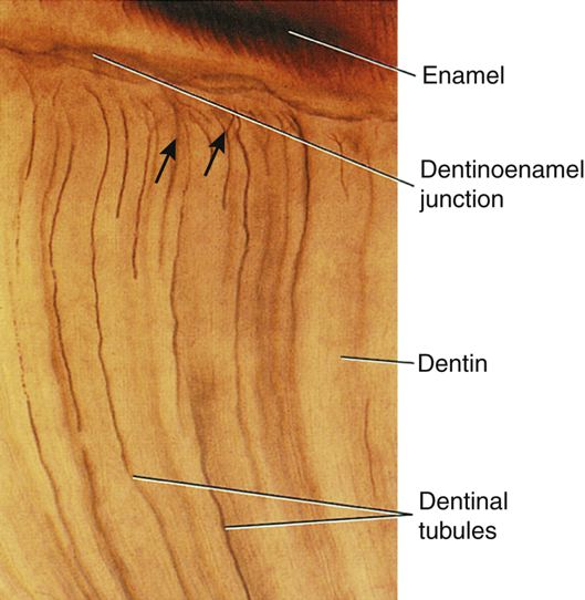 A close-up image of a tooth section highlighting the enamel, the dentinoenamel junction, dentin, and the dentinal tubules.