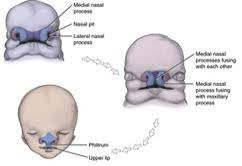 Three illustrations showing the development of facial features in an embryo, highlighting the medial nasal process, lateral nasal process, nasal pit, and the fusion of the medial nasal processes with each other and with the maxillary process to form the philtrum and upper lip.