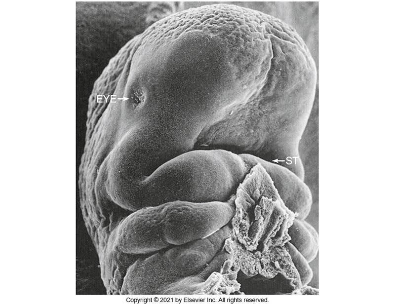 Electron microscope image of a human embryo in the fourth week of development, labeled with "EYE" and "ST" to indicate the early formation of the eye and somites.