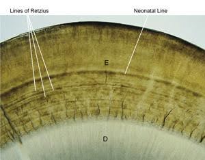 A microscopic image showing a tooth's enamel with the Lines of Retzius and the neonatal line labeled, above the dentin layer.