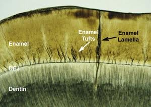 A microscopic image of a tooth cross-section highlighting the enamel, enamel tufts, enamel lamella, and the underlying dentin.