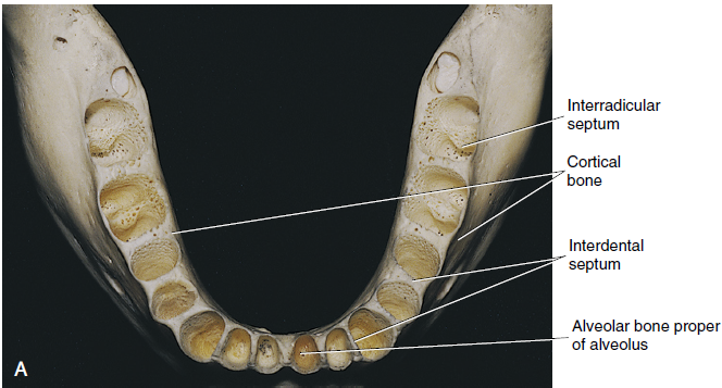 A photograph of a human lower jawbone displaying the alveolar process with labeled sections including the interradicular septum, cortical bone, interdental septum, and alveolar bone proper of alveolus.