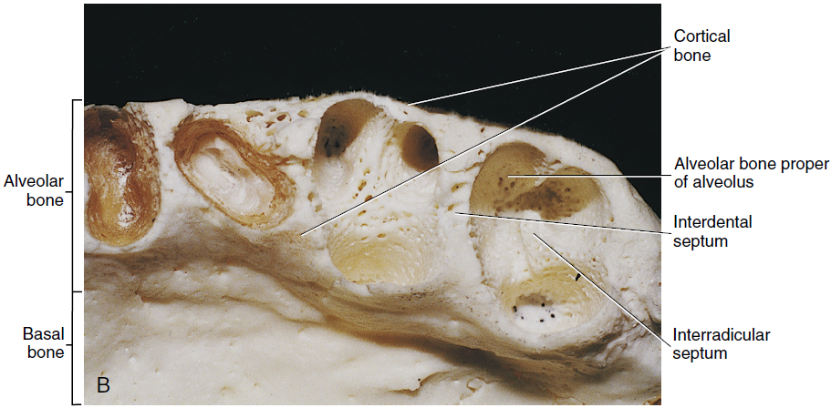 A close-up photograph of a sectioned jawbone showing the alveolar and basal bone with detailed areas labeled, including cortical bone, alveolar bone proper of alveolus, interdental septum, and interradicular septum.