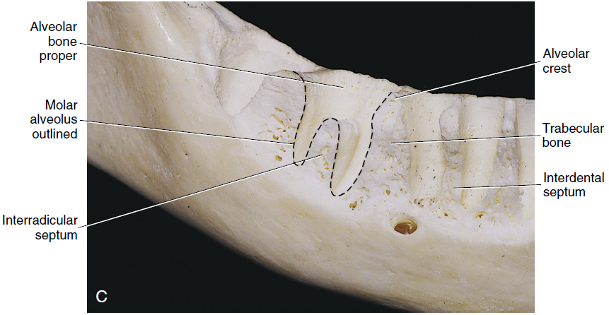 A photograph of a human jawbone highlighting the alveolar bone proper, molar alveolus, interradicular septum, alveolar crest, trabecular bone, and interdental septum with labeled indicators.